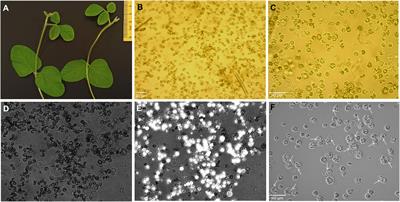 Establishment of targeted mutagenesis in soybean protoplasts using CRISPR/Cas9 RNP delivery via electro−transfection